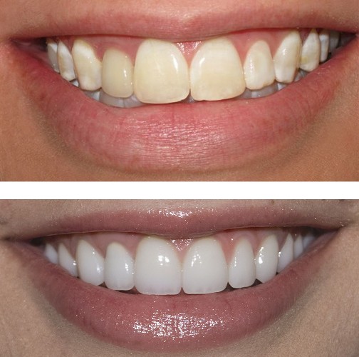 Cosmetic Dentistry